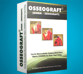 osseograft