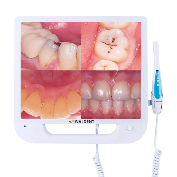 8 intraoral_camera_1_2